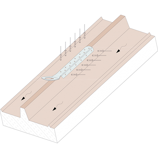 null Single profiled anchor point for lifelines type A 100